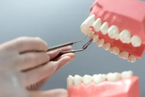 Mini Dental Implants vs Traditional Implants